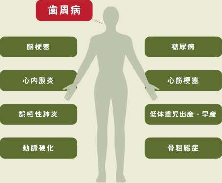 歯周病と全身の関わり