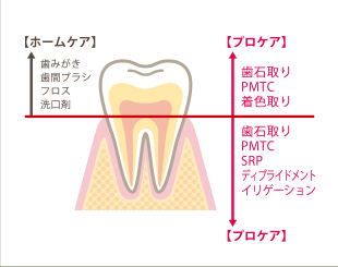 3つの理由2